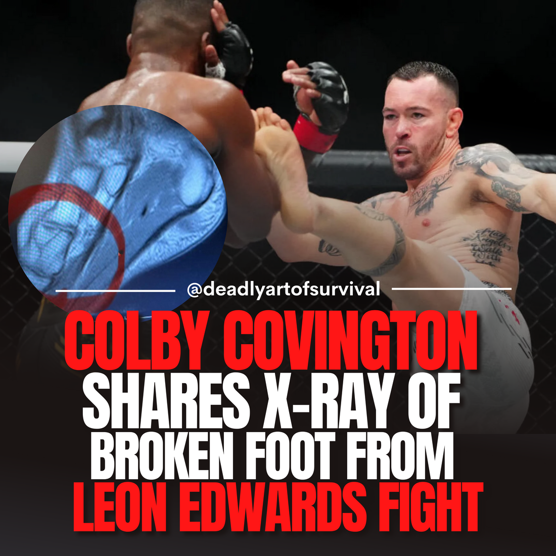 Colby-Covington-Reveals-X-Ray-Of-His-Broken-Foot-Blaming-It-For-His-Loss-To-Leon-Edwards deadlyartofsurvival.com