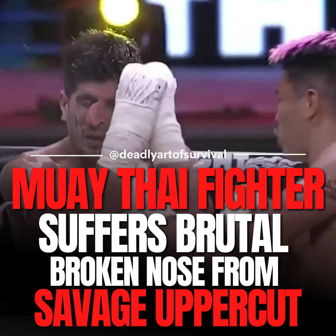 Muay-Thai-Fighter-Shayan-Heydari-Suffers-Brutal-Broken-Nose-in-Latest-Bout deadlyartofsurvival.com